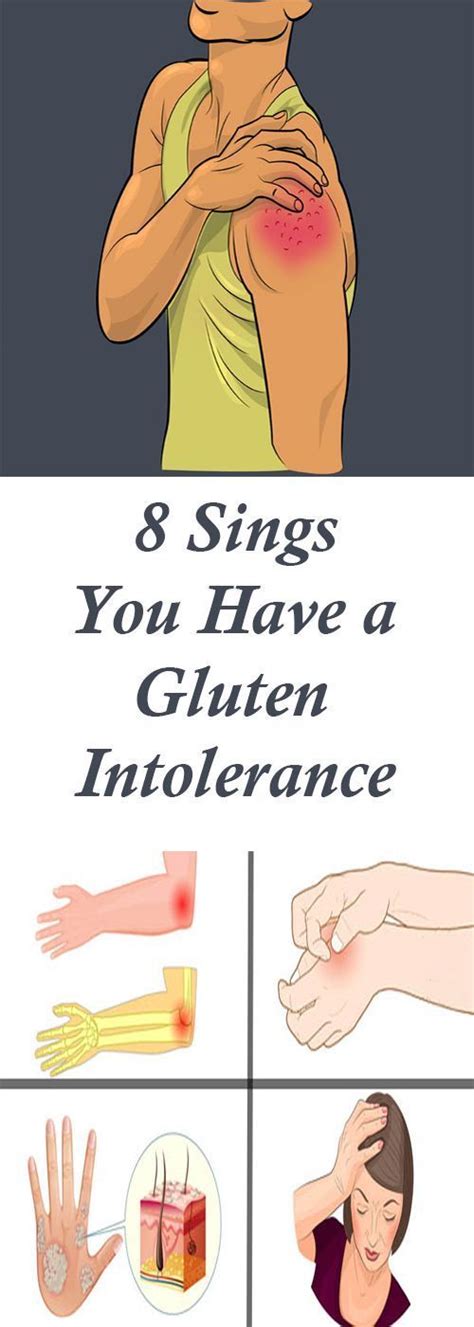 The 8 Most Common Signs Of Gluten Intolerance Health Hacks