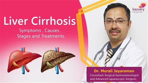 Liver Cirrhosis Symptoms And Treatment கல்லீரல் சிரோசிஸ்