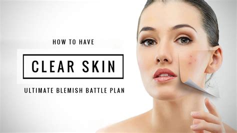 Acne 101 And What Is Acne Annie Beauty Spa