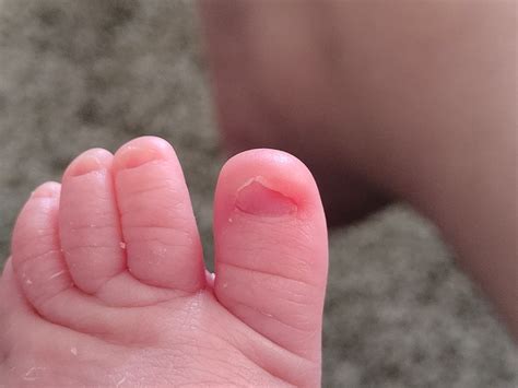 Toenails Babycenter