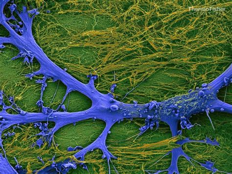 Brain Cells Under Electron Microscope Micropedia