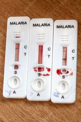 Malaria Rapid Diagnostic Test Strips Stock Image C Science Photo Library