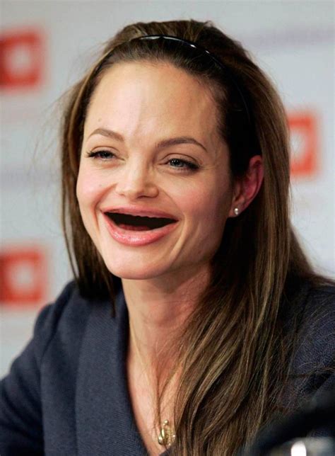 1000 Images About Celebrities With No Teeth On Pinterest
