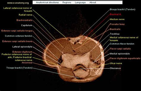 Bone cross section illustrations & vectors. Arm, forearm, and hand: MRI of anatomy