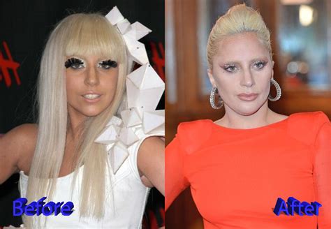Lady Gaga Plastic Surgery Is It Real Or Not