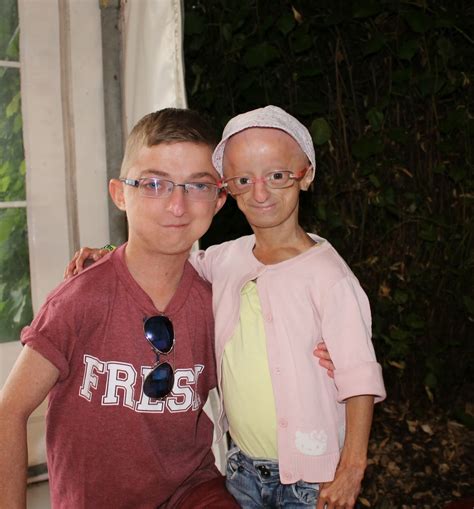 Atypical Progeria Syndrome Harrys Story Progeria Reunion Denmark 2014