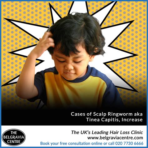 Cases Of Scalp Ringworm The Belgravia Hair Loss Centre