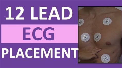 12 Lead ECG Placement of Electrodes EKG Sticker Lead Procedure สรป