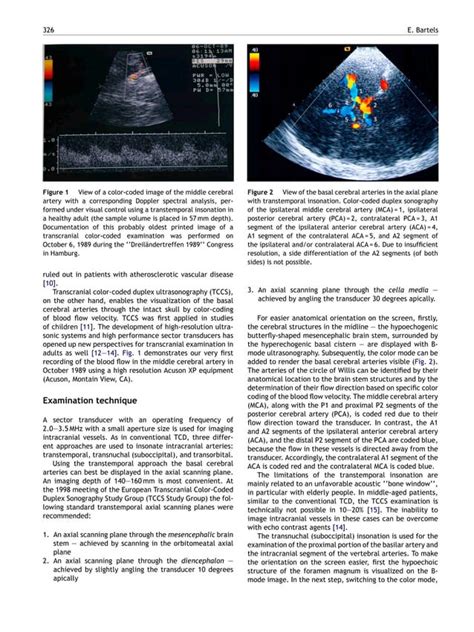 Transcranial Color Coded Duplex Ultrasonography In Routine