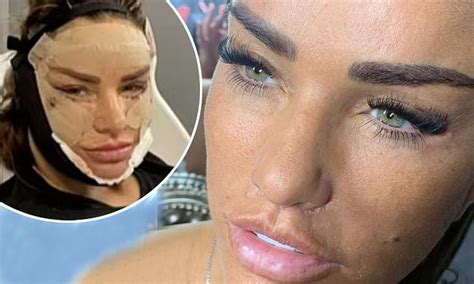 Katie Price Shares Completely Unfiltered Close Up Shot Of Her Face