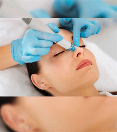 Dermalinfusion Facial Treatments Benefits And Side Effects