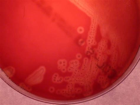 Streptococcus Agalactiae Group B Streptococci Microbiology Medbullets Step 1