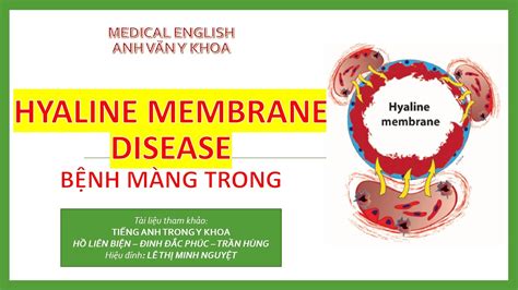 HYALINE MEMBRANE DISEASE BỆNH MÀNG TRONG YouTube