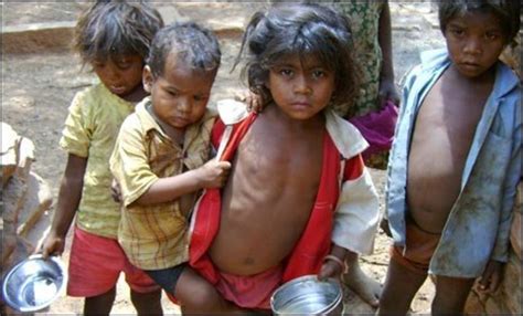 India Shamed By Child Malnutrition Says Pm Singh Bbc News
