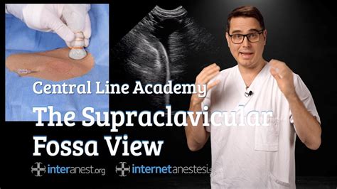 Central Line Academy The Supraclavicular Fossa View Youtube