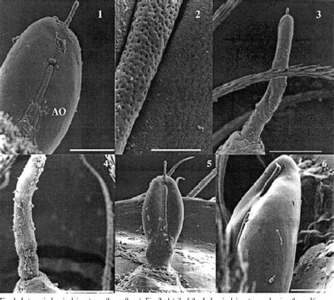 Figure From External Morphology Of Sensory Structures Of Fourth Instar Larvae Of Neotropical
