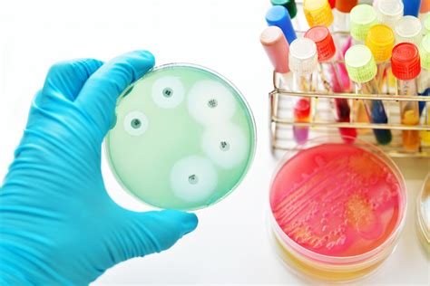 Antibiotic Susceptibility Testing Ast Synbiosis