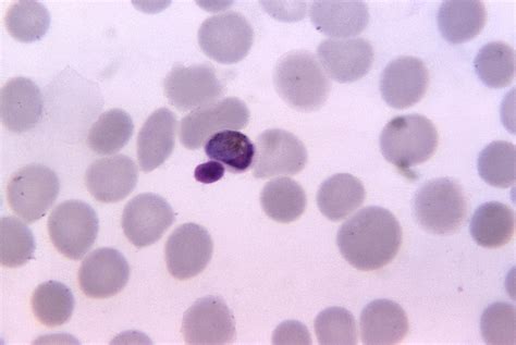 Free Picture Photomicrograph Mature Plasmodium Malariae Trophozoite