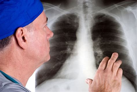 Wie Lungenkrebs Diagnostiziert Wird