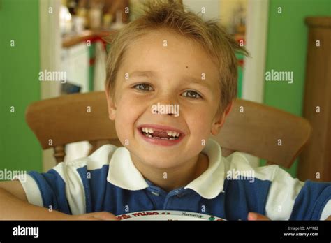 Young Boy Aged 7 Showing His Missing Front Teeth Stock Photo Alamy