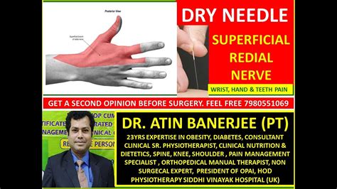Dry Needling On Superficial Radial Nerve Treatment Wrist And Hand Pain Dr