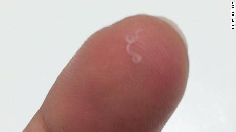 If you actually have worms in your stool, it must be evaluated. Worm in woman's eye leads to unique discovery - CNN