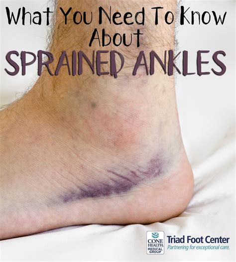 Heres What You Need To Know About Sprained Ankles