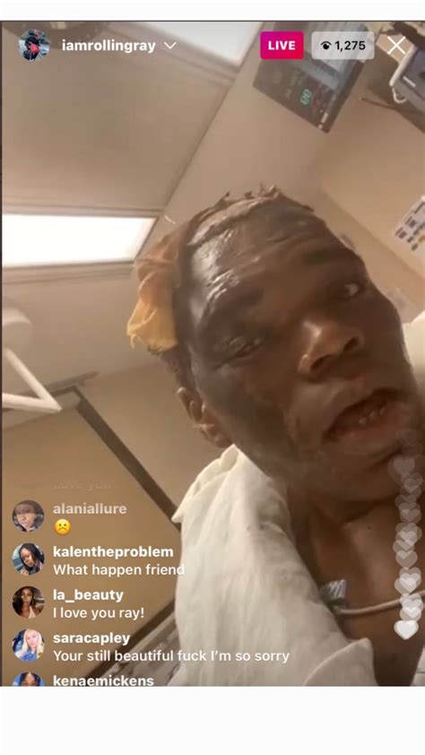 Internet Personality Rolling Ray Hospitalized After His Wig Caught On