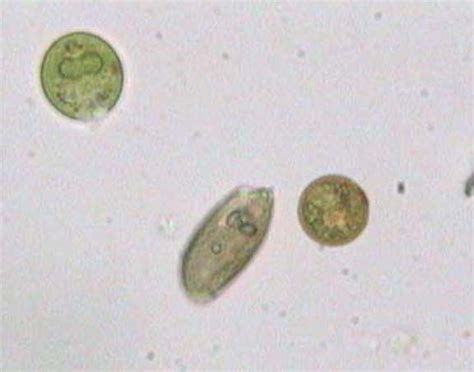 Microscopic Organisms In Pond Water
