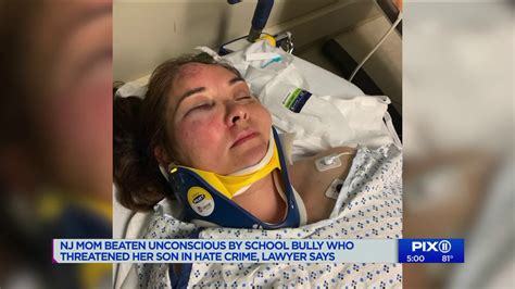 Nj Mom Beaten Unconscious By School Bully Who Threatened Her Son