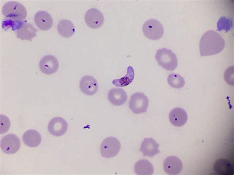 Plasmodium Falciparum Qué Es Características Ciclo De Vida Síntomas