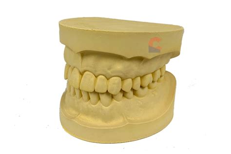 Dentulous Cast Ideal Cast New Citizens Dental Supply And General