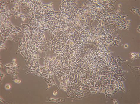 This site is using cookies under cookie policy. Human embryonic stem cells in culture created