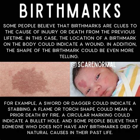 Birthmarks Spiritual | Psychological facts interesting ...