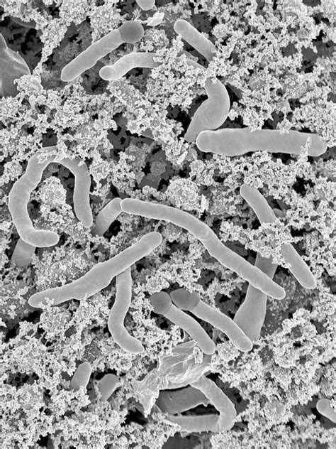 Geobacillus Stearothermophilus Photograph By Dennis Kunkel Microscopy