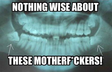25 Wisdom Teeth Memes That Are Too Funny For Words Wisdom Teeth Impacted