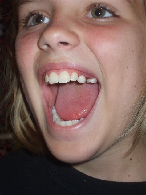 How to pull a loose tooth out adults. A Marine & all his girls: My toothless wonder