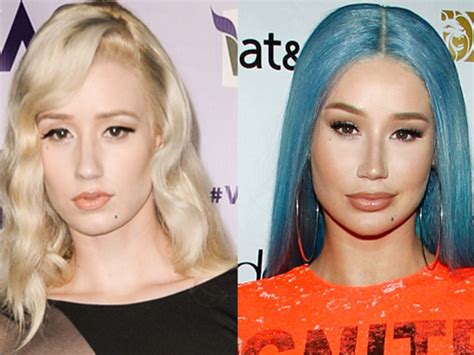 Iggy Azalea Booty Implants Before And After