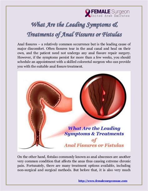 What Are The Leading Symptoms And Treatments Of Anal Fissures Or Fistulas