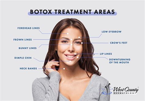 Botox Treatment Chesterfield Mo West County Dermatology