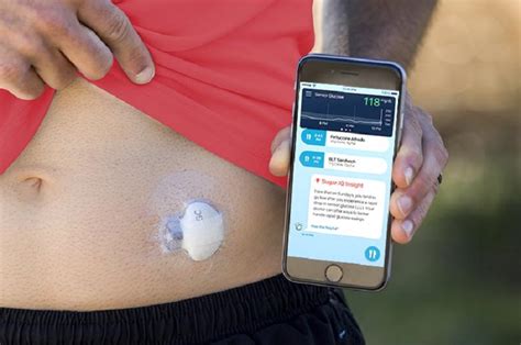 Happy friday to all my diabetic connect friends. Guardian Connect CGM's new "Sugar.IQ" Diabetes Assistant App - Diabetes Daily