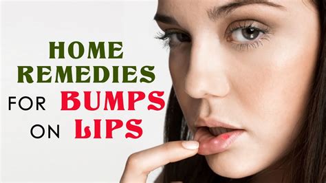 9 Remedies For Bumps On Lips To Treat Naturally At Home Youtube