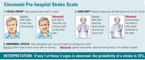 Cincinnati Pre Hospital Stroke Scale Nurses Zone Source Of Resources For Nurses