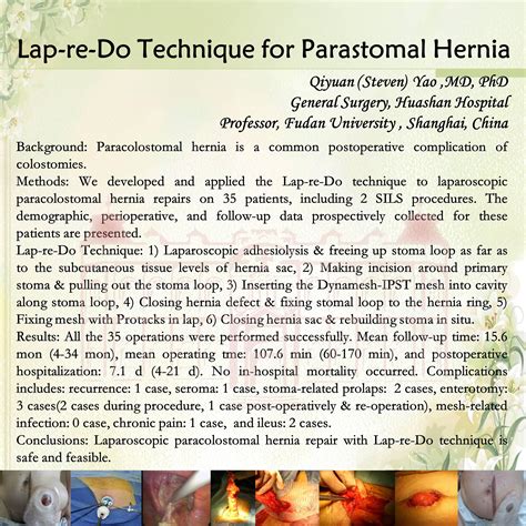 Laparoscopic Parastomal Hernia Repair And Re Ostomya Totally New Lap