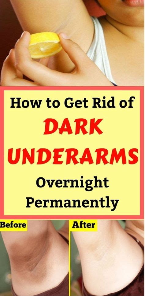 How To Get Rid Of Dark Underarms Overnight Permanently Dark Underarms