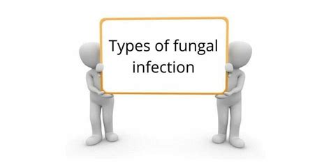 Types Of Fungal Infection A Complete Overview Pharmacist Opinions