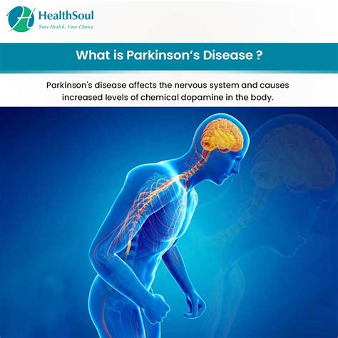 Parkinsons Disease Symptoms Diagnosis And Treatment Healthsoul