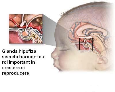 Poze Medicale Tumorile Hipofizare Ale Glandei Pituitare