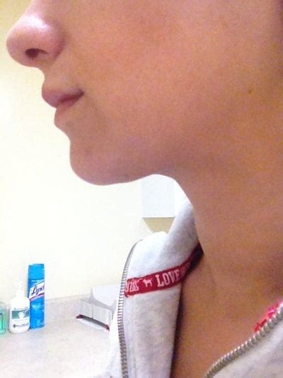 How do i get rid of a double chin without surgery. What Can I Do to Get Rid of my Jowls or Double Chin ...