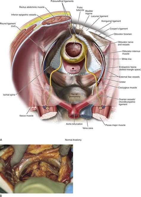 Anatomía del espacio retropúbico Clinical Gate Online Stream
